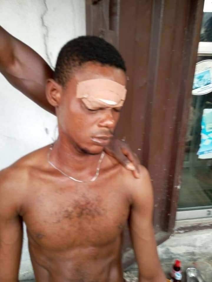 Graphic: Lady stabs her boyfriend in the eye over a phone call