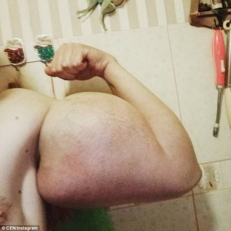 Photos: Russian Man Shows Off His 24inch Biceps After Injecting His Muscles With Dangerous Chemicals