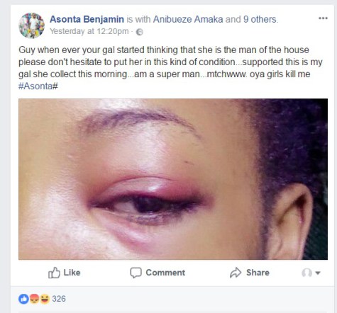 Nigerian Guy Asonta Benjamin Beats Up His Girlfriend Nearly Blinding Her Then Brags About It On Facebook