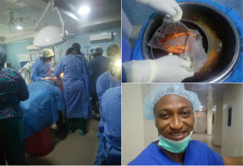 First Ever Successful Kidney Transplant In South East Takes Place At FMC Umuahia (Photos)