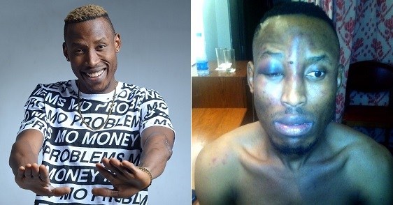 Singer Mr 2kay robbed, beaten in his Hotel room during 2face's show at Eko Hotel