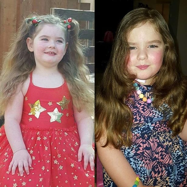 5 Year Old Girl Grew Br£asts At 2, Started Her Period At 4 And Is Going Through Menopause Now At Age 5. (Photos)