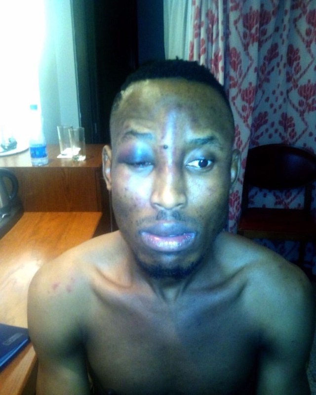 Singer Mr 2kay robbed, beaten in his Hotel room during 2face's show at Eko Hotel