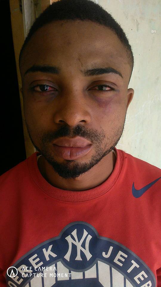 Corps member narrates how he was assaulted by some Katsina State police officers while returning from church