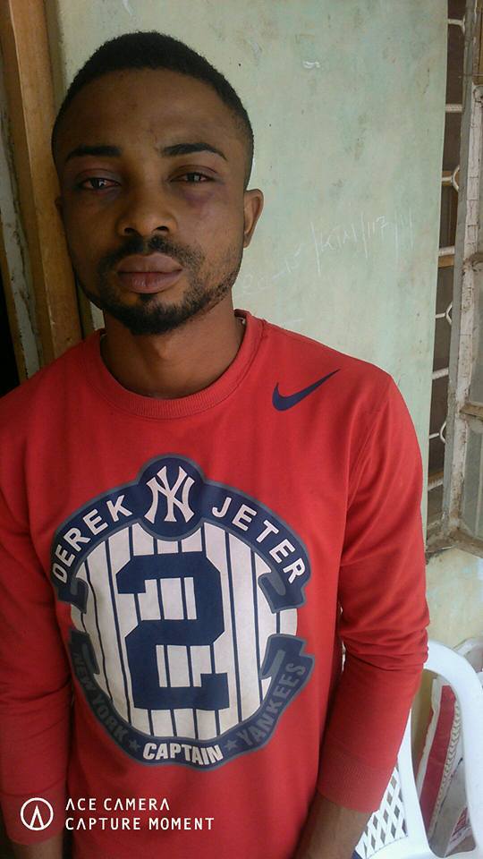 Corps member narrates how he was assaulted by some Katsina State police officers while returning from church