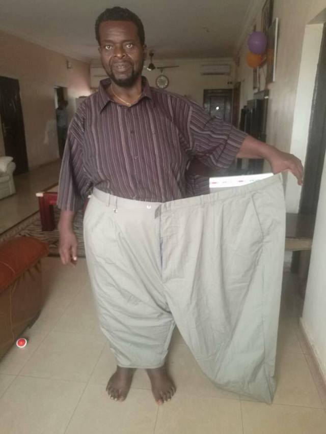 Unbelievable Before and After Photos of a man from Enugu State after his rigorous weight loss procedure
