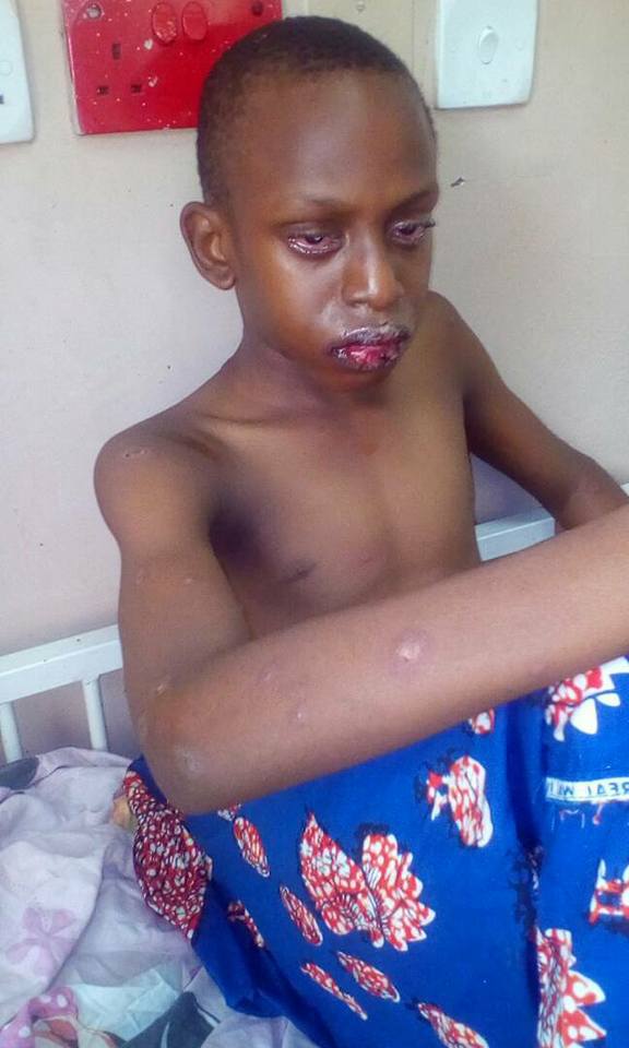 Nigerian boy almost dies after consuming juice (photos)
