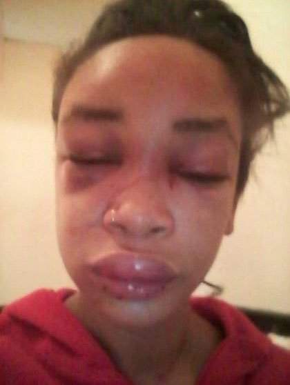 Lady cries out after her boyfriend and his friends beat her for not giving him money