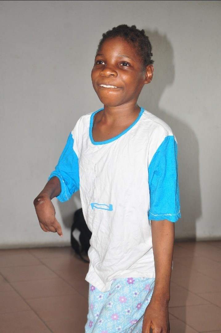 Little girl with cerebral palsy who was dumped in the pit latrine by her mother, rescued and given a better life by Good Samaritans