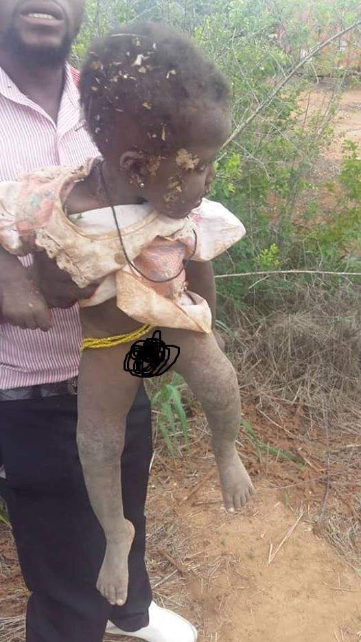 10-month-old baby girl rescued in Ghana after being buried alive by her mother (Photos)
