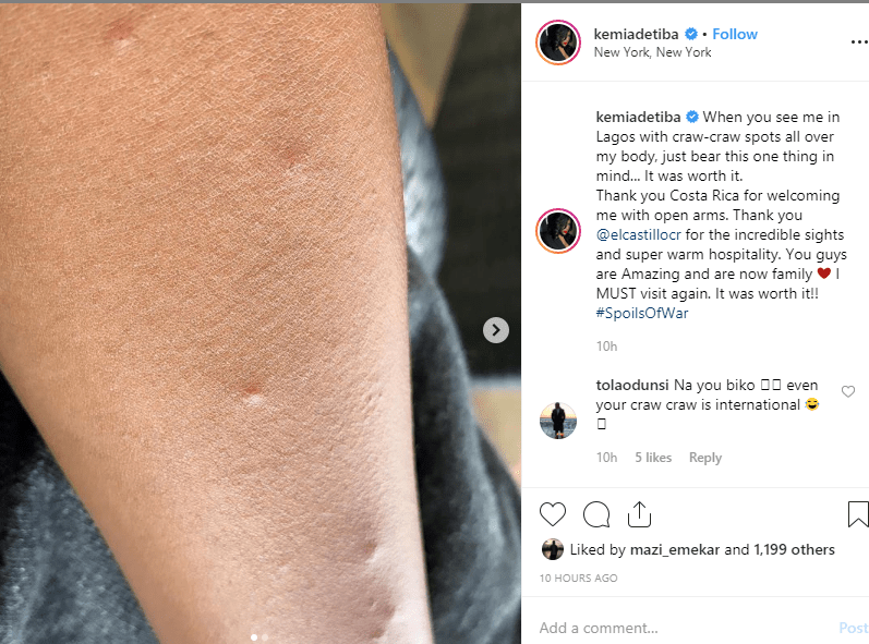 Kemi Adetiba shares photos of what Costa Rican Mosquitoes did to her body