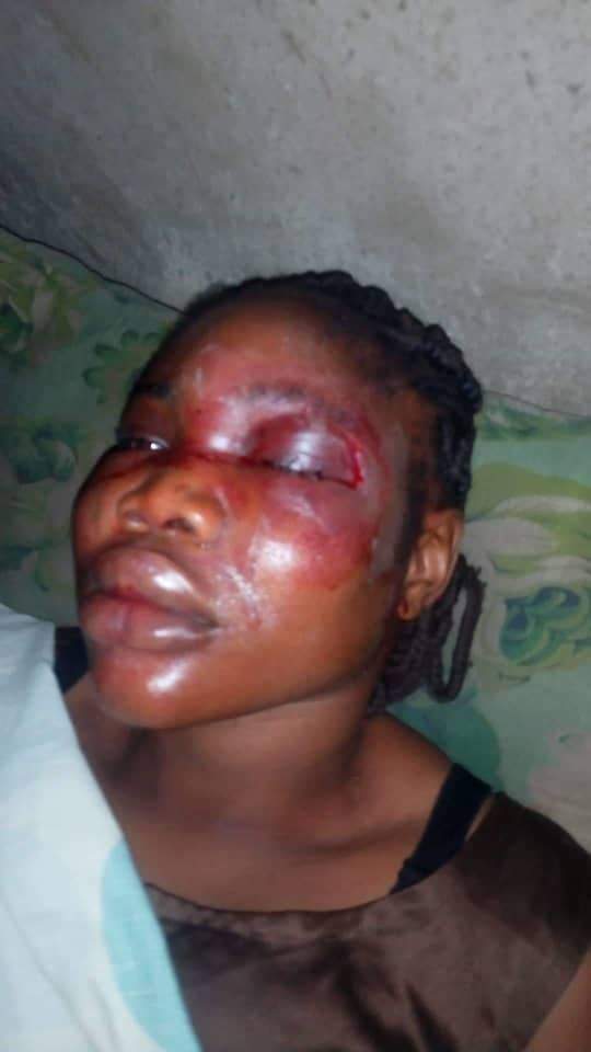 Nigerian Man exposes his Cousin's fiancee who beat her to unrecognizable levels.