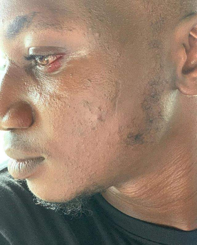 Peruzzi apologises to Pamilerin for assaulting him