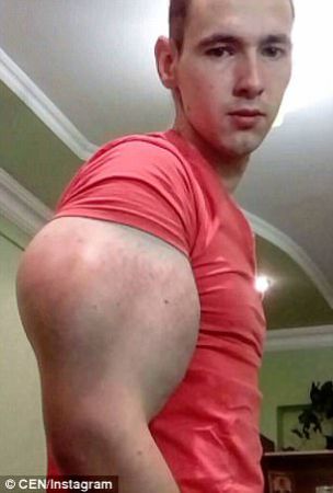 Photos: Russian Man Shows Off His 24inch Biceps After Injecting His Muscles With Dangerous Chemicals