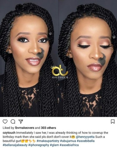 Meet Beautiful Nigerian Lady Who Says She'd Never Cover Up Her Big Dark Facial Birthmark (Photos)