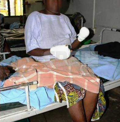 Photos: Man Chops Off Wife's Hand With A Machete For Overstaying At A Funeral