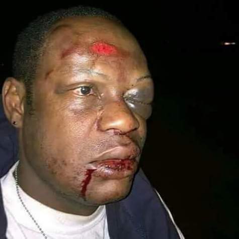 Nigerian Guy Was Beaten Mercilessly For Allegedly Having S3x With Another Man's Wife