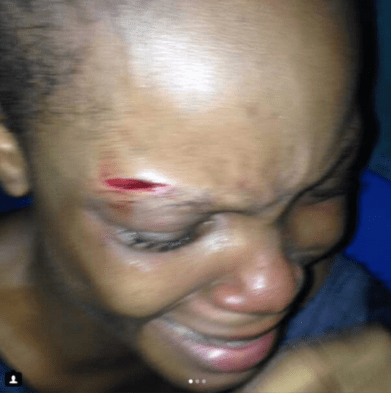 Nigerian Lady Outs Friend Who Stole Her Money And Assaulted Her After Giving Her Project Money To Her Boyfriend (Photos)