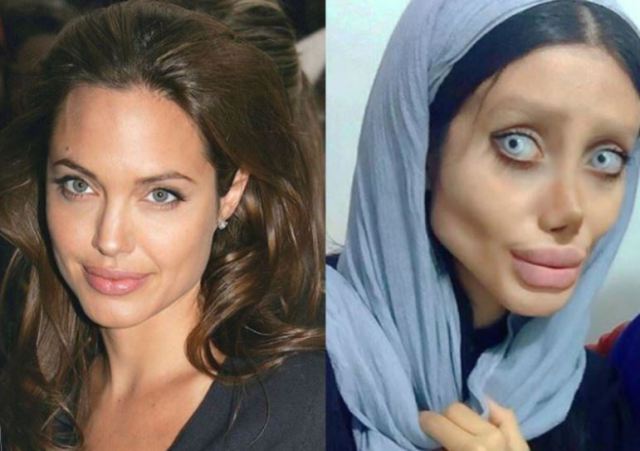 19 year old girl undergoes 50 surgeries to look like Angelina Jolie but it went horribly wrong