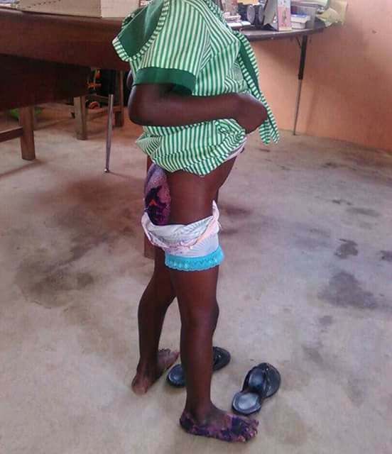 Pregnant Ghanaian Lady Dumps Her 5-Year-old Step-Daughter Inside Hot Water For Bed-wetting (Photos)