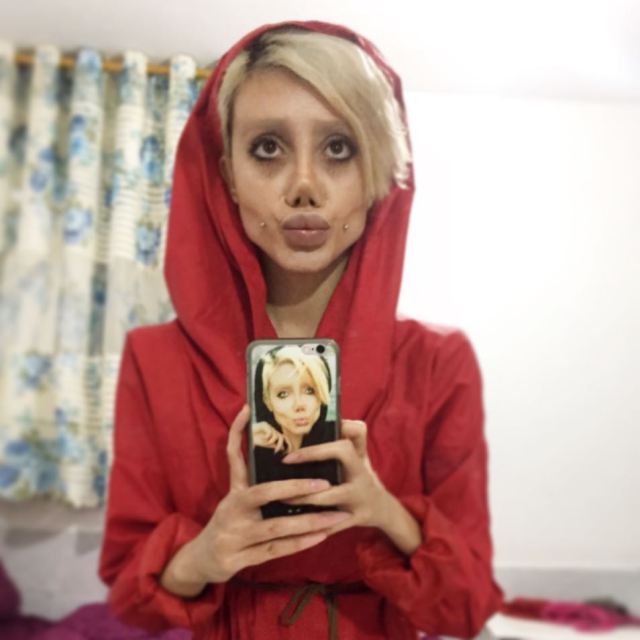 19 year old girl undergoes 50 surgeries to look like Angelina Jolie but it went horribly wrong