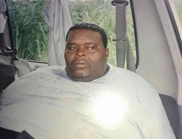 Unbelievable Before and After Photos of a man from Enugu State after his rigorous weight loss procedure