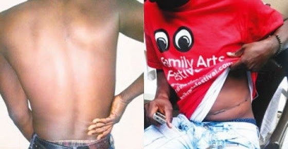 'I sold my kidney for N15 million in Malaysia'