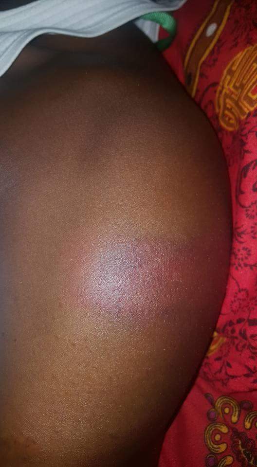 'You are a terrorist and a criminal' - Police beat up Corper in Delta state