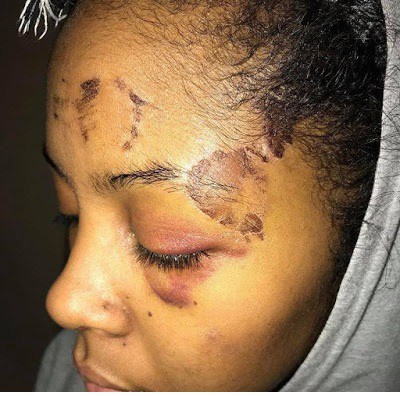 Police officer allegedly brutalize beautiful lady, bangs her face into a concrete
