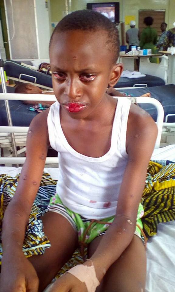 Nigerian boy almost dies after consuming juice (photos)