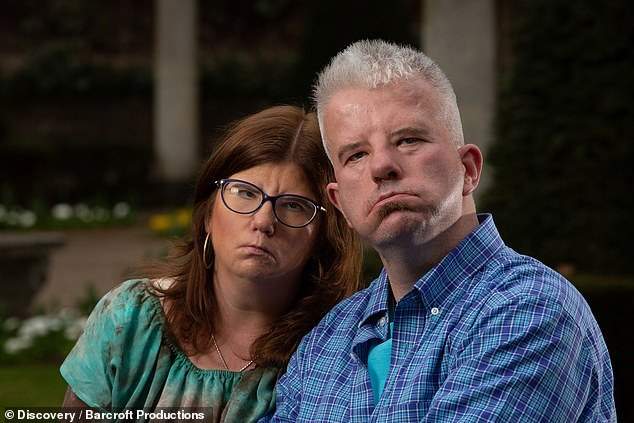 Couple who can't smile because of rare condition fall in love (photos)