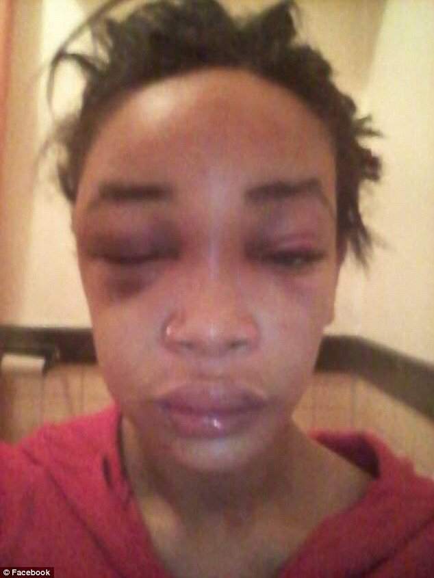 Lady cries out after her boyfriend and his friends beat her for not giving him money