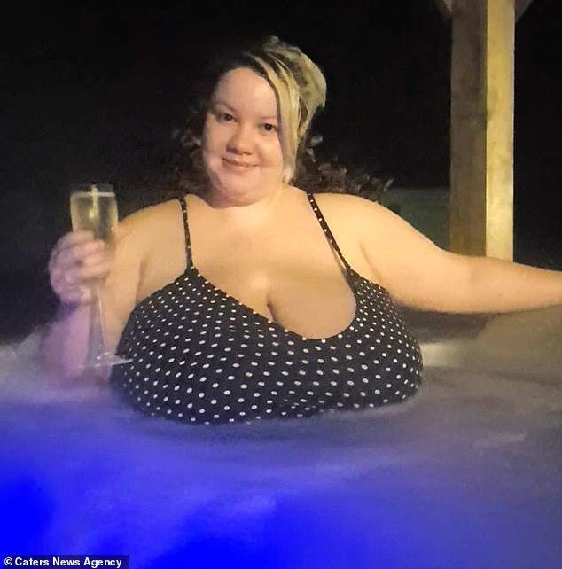 Meet 25-year-old lady with gigantic breasts that won't stop growing due to a rare condition (Photos)