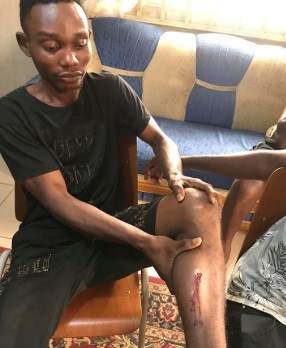 Young man hit by stray bullet during alleged SARS raid in Edo (Photo)