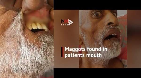 South African man dies after maggot infestation in his mouth (Video)
