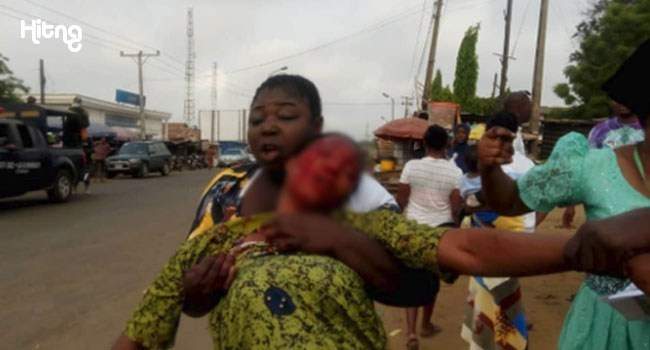 Woman Stabbed In Fight At Polling Unit In Osun State