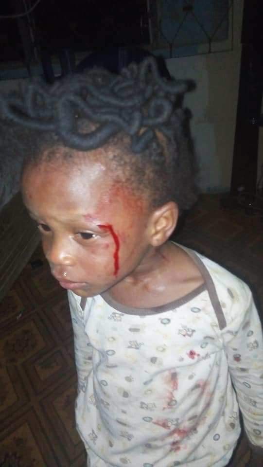 2-year-old girl brutalized for not being about to count 1 to 200 in Ondo State