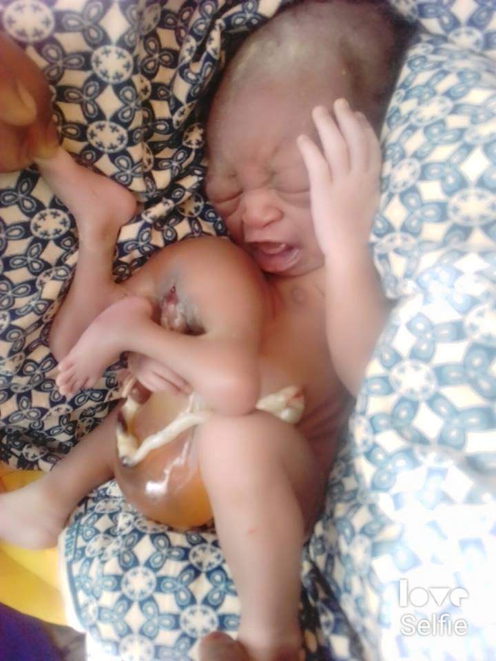 Baby Is Born With Four Legs In Bauchi State