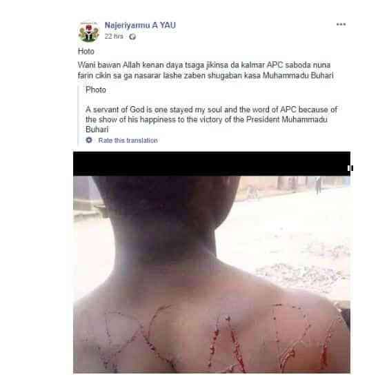 Man bleeds after tattooing APC into his skin to celebrate President Buhari's re-election