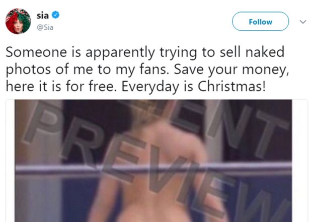Sia Posts Nayked Photo To Take On Paparazzi Trying to Sell It (!8+ Photo)