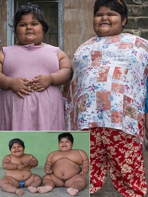 World's Fattest Sisters', Aged 6 And 8 Finally Undergo weight Surgery. (Photos)