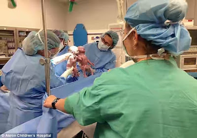 Twin Sisters Who Were Born Holding Hands Are Still Inseparable Two Years After