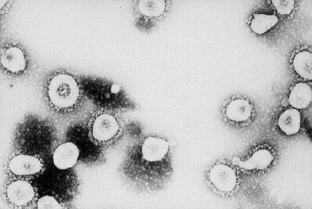 Coronavirus: Here are 10 states with confirmed and suspected cases of Covid-19 in Nigeria