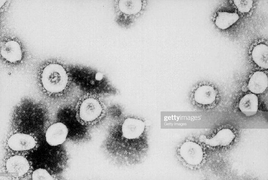 Coronavirus in Nigeria - Federal govt confirms (Full statement)