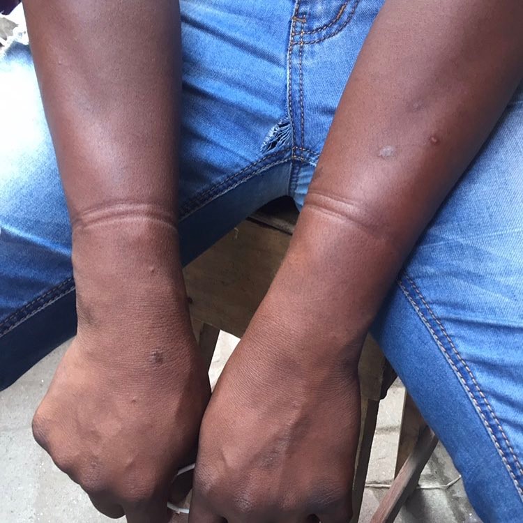 See What SARS Did To A Man Accused Of Being A Yahoo Boy