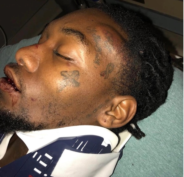 Offset after his car crash (lib)